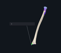 <p>Name the boney landmark indicated by the X and highlighted green</p>