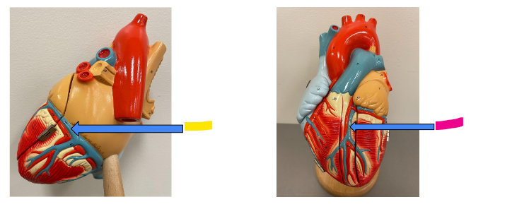 <p>What is the yellow arrow?</p>
