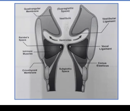 <p>vestibule or an opening right above the VF</p><p>right above this vesituble are the FALSE VF</p><p></p><p>the mucous glands in the vesitbule is extremely important</p>