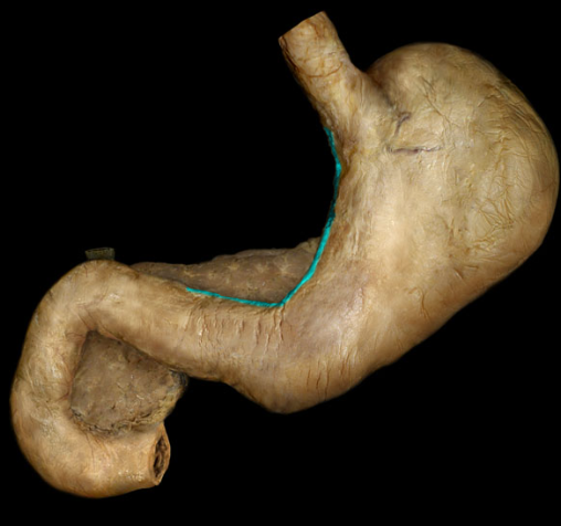 <p>left and inferior border of the stomach, attached to the lesser omentum</p>