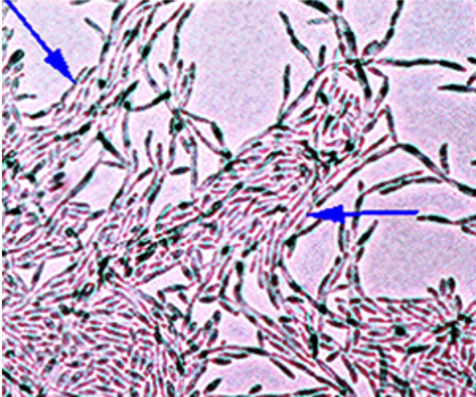<p>The growth of yellow-white yeast colonies with a smooth or hair-like structure within 2-3 days on non-selective culture media generally requires further procedures to make a presumptive identification. Observation of colonies are growing on cornmeal agar. Note the “logs in-steam” arrangement of elongated blastoconidia.What is the ID of the yeast? </p>