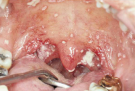 <p>what is this condition  </p>