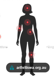 <p><span style="line-height: 23.25px;"><strong>Systemic lupus </strong></span><span style="line-height: 23.25px; color: rgb(8, 7, 7);"><strong>erythematosus: </strong></span></p><p><span style="line-height: 23.25px; color: rgb(2, 1, 1);"><strong>disease causes an overactive and misdirected immune system that affects the entire body and can cause joint pain, fatigue, and hair loss. </strong> </span></p>