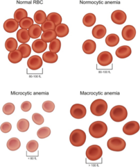 <p>Iron (Fe) deficiency.</p>