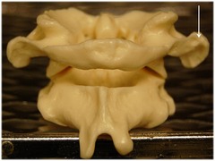 <p>Name this specific part of the atlas (C1).</p>