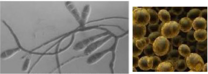 <p><span style="color: rgb(255, 255, 255);">The pictures shown here represent the same organism at different stages in its life cycle. What is the organism?<br>A. a type of algae<br>B. a type of fungus<br>C. a protozoan<br>D. a bacteriophage<br>E. a type of archaea</span></p>