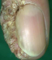 <p>Verrucae Vulgaris</p><ul><li><p>what is it</p></li><li><p>what might you find</p></li><li><p>location</p></li></ul><p></p>