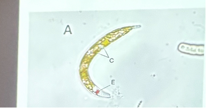 <p>What is this organism?</p>