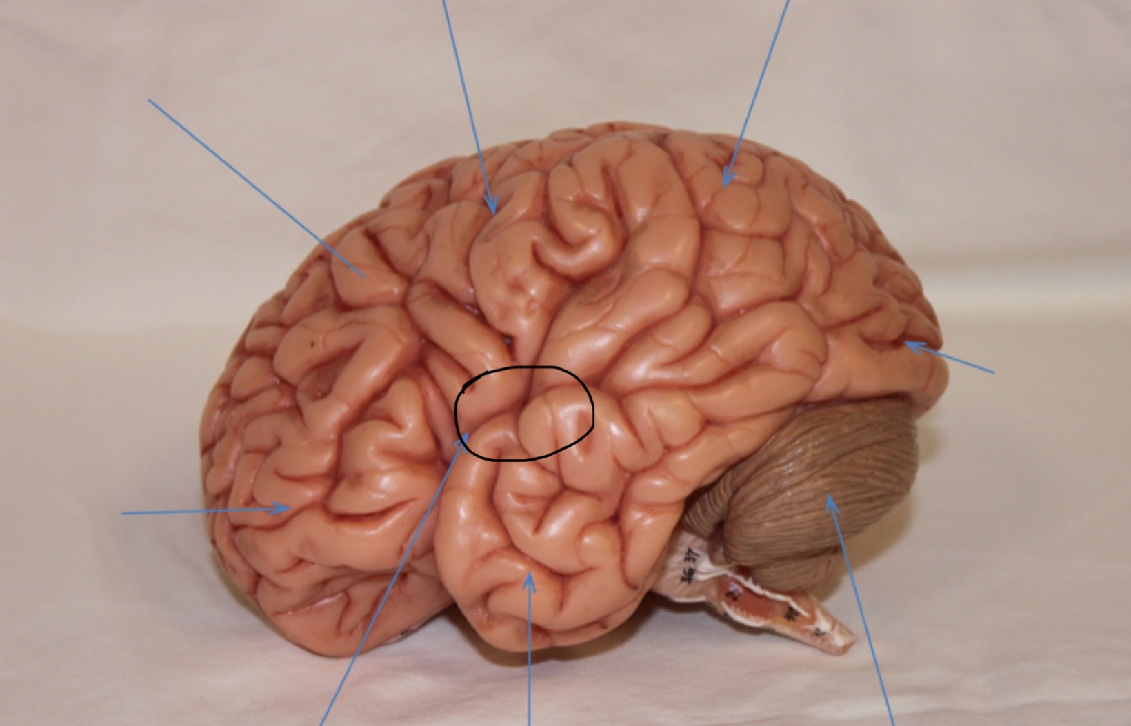 <p>Identify the circled area?</p>