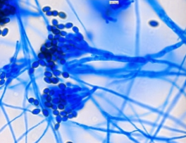 <p>Rough lemon drop conidia</p>