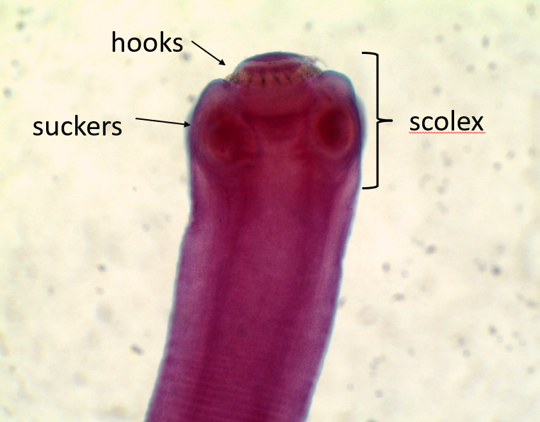 <p>Helminths</p>