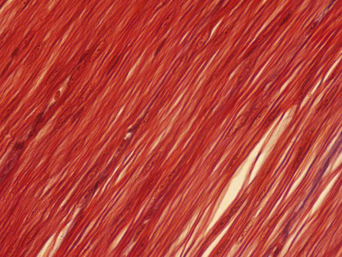 <p>Identify the type of muscle tissue shown? </p>