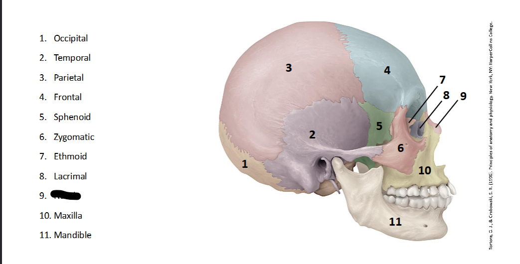 <p>What landmark within the <strong>Skull? (LATERAL)</strong></p>