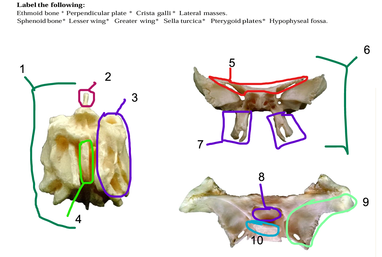 <p>structure 2</p>