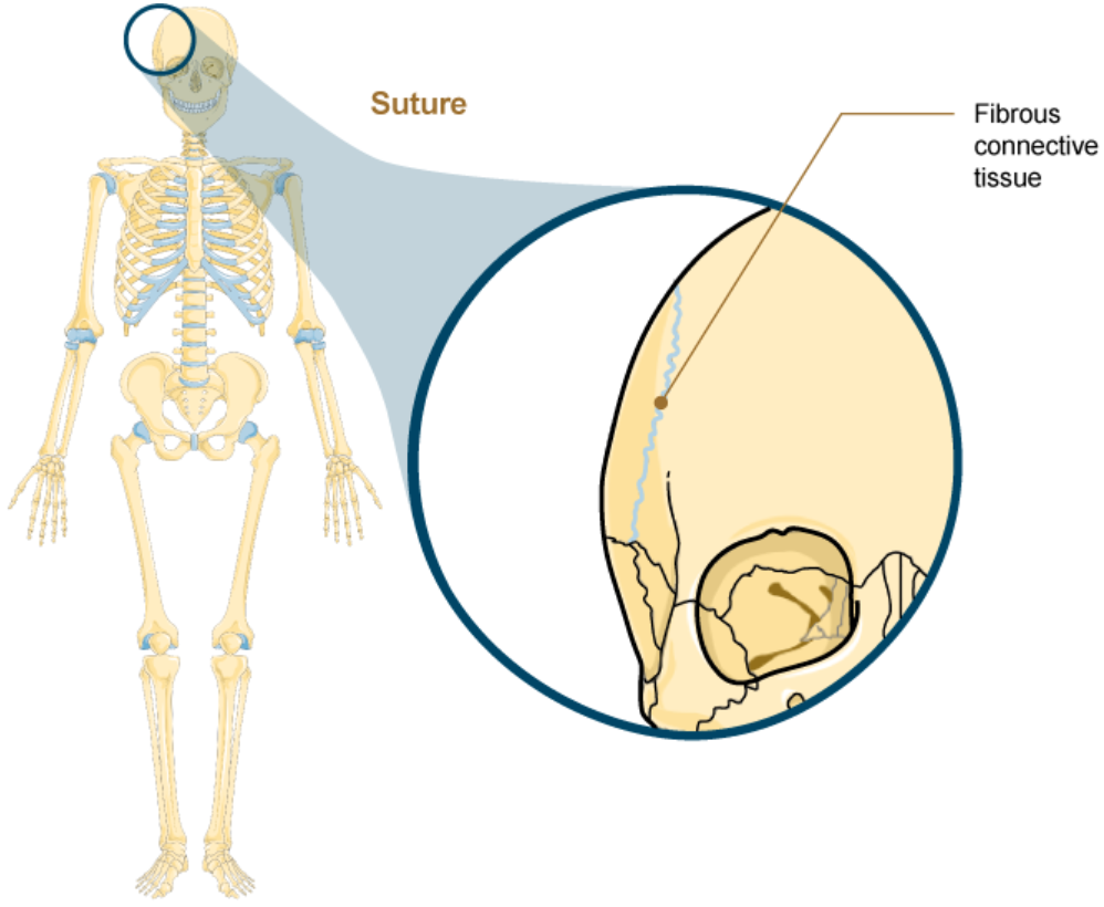 <p>Suture</p>