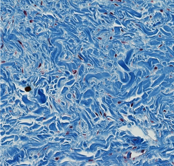 <p><span style="font-family: "Calibri Light";">Which type of CT is this?</span></p>