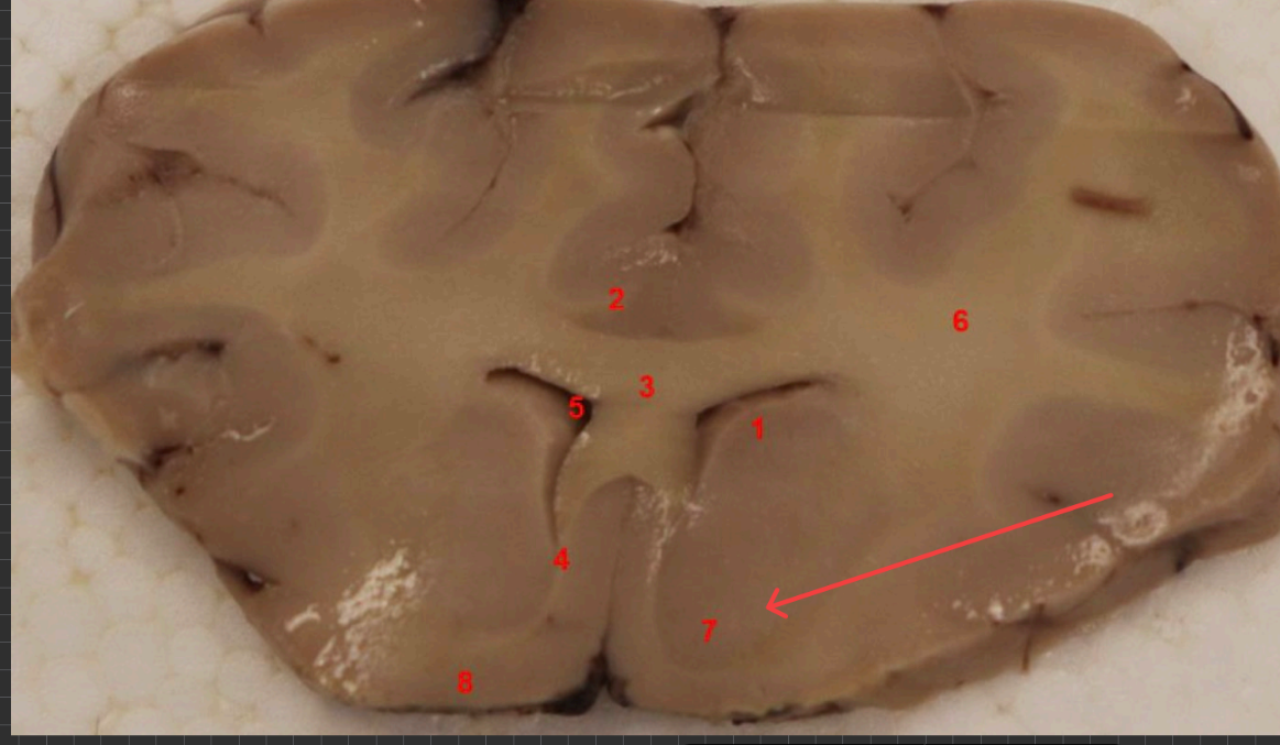 <p>what area is this, function? </p>