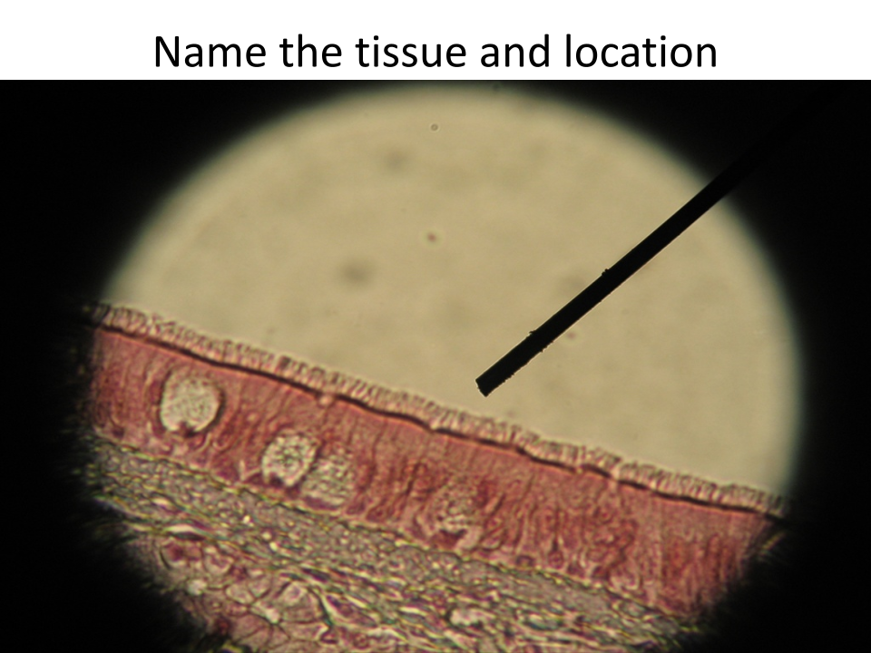 <p>Location of tissue?</p>