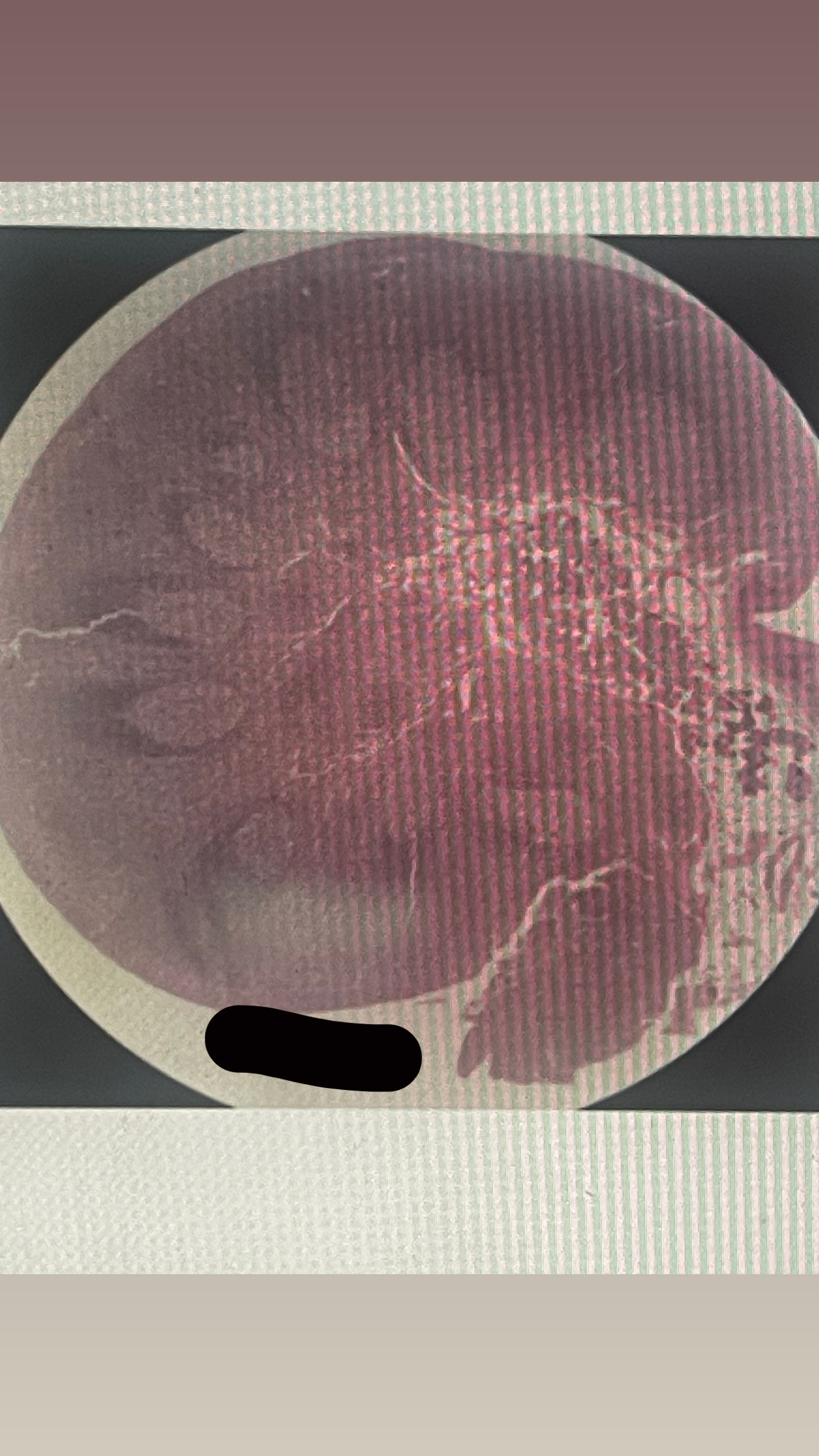 <p>identify lymphatic organ </p>