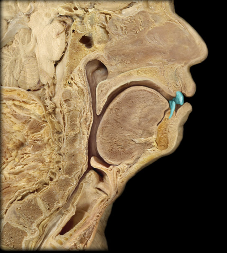 term image