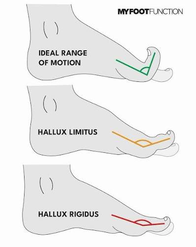 <p>Movements of (Toes) each</p>