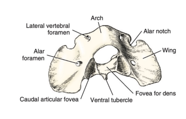<p>Q: Characteristics of the ATLAS = C1 include:</p><ol><li><p>modified articular processes that "cup" the occipital condyles,</p></li><li><p>winglike lateral expansions,</p></li><li><p>lack of spinous process,</p></li><li><p>…… </p></li></ol><p></p><p>A. Reduction of its body to form a vertebral arch </p><p>B. Reduction of its body to form a costal arch </p><p>C. Reduction of its body to form a ventral arch </p><p>D. Reduction of its body to form a hemal arch</p>
