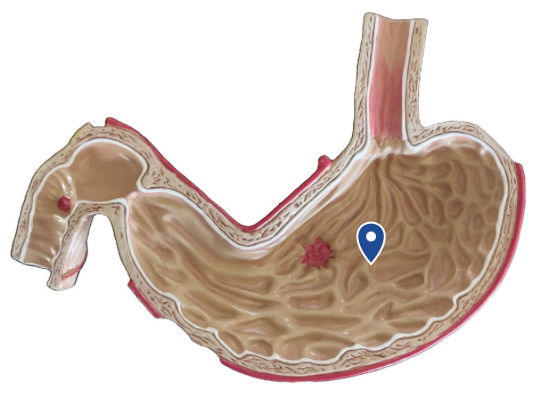 <p>Name these ridges over the inner surface of the stomach.</p>
