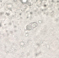 <p>genus, species, stage</p>