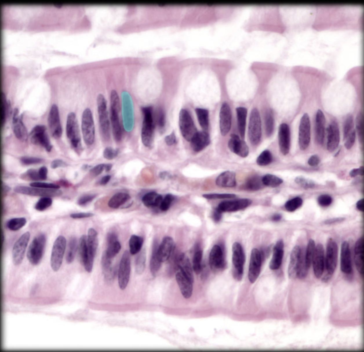 term image