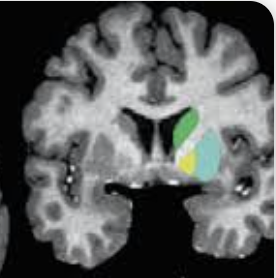 <p>Name the highlighted areas and the plane of view</p>