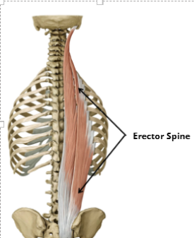 <p><span style="background-color: inherit; line-height: 20.7px;">are a group of muscles that help to keep the spine erect. They run down both sides of the spinal column.</span><span style="line-height: 20.7px;">&nbsp;</span></p>
