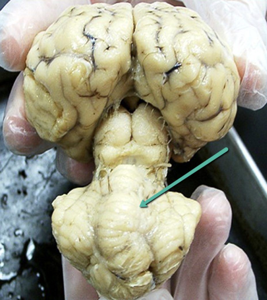 <p>Identify the structure indicated by the pointer.</p>