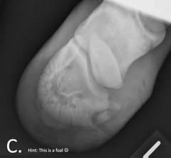 <p>Which fracture type is this?</p>