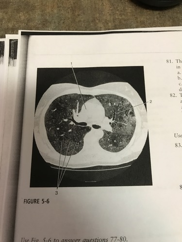 <p>Number 1 on the figure corresponds to what?</p><p>A) right atrium </p><p>B) pulmonary trunk</p><p>C) ascending aorta </p><p>D) right ventricle </p>