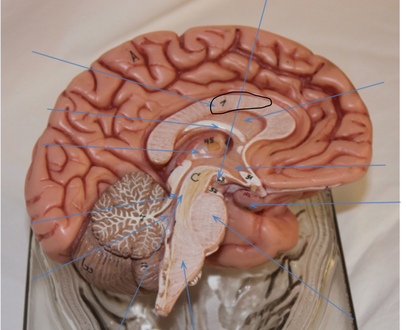 <p>Identify the circled area?</p>