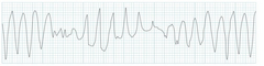 <p>identify the rhythm</p>