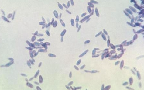 <p>“cigar-shaped” yeast cell</p>