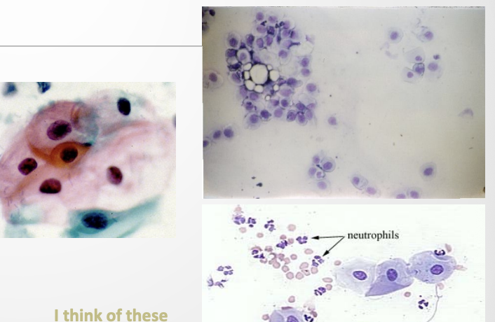 <p>Intermediate Cells (Epithelial) </p>