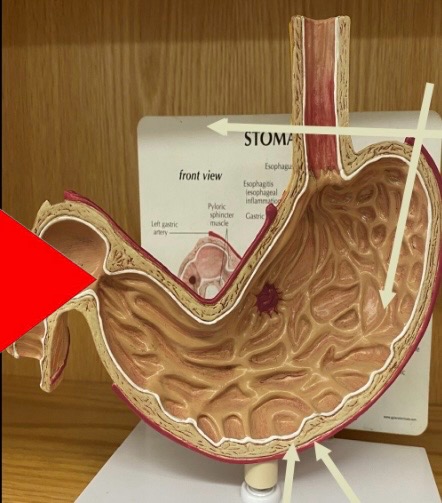 term image