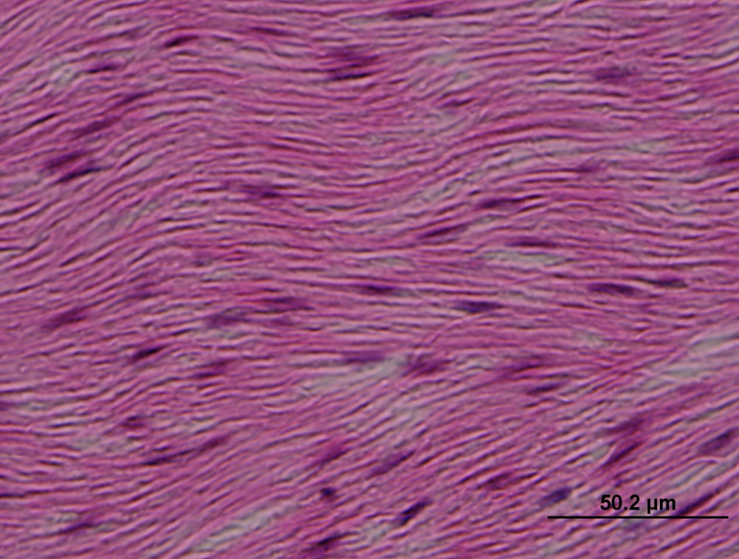 <p>name the fibers that are ‘glowing’ or refracting light</p>