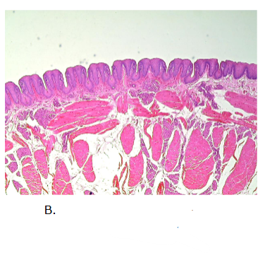 <p>what gland is this?</p>