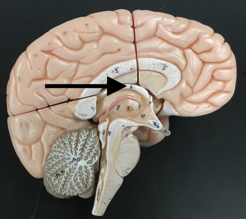 <p>What is the arrow pointing to?</p>