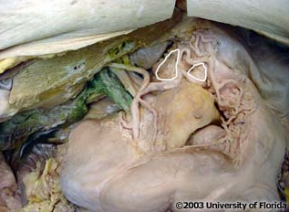 <p>what nerve structure is being highlighted in the image</p>