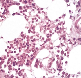 <p>The image shown in this section most likely has been: </p><p>a. understained </p><p>b. underdecalcified </p><p>c. overdecalcified </p><p>d. poorly fixed</p>