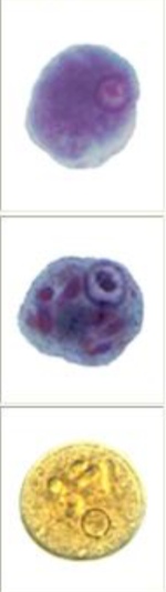 <p>many small pointed/angular chromatid bodies</p>