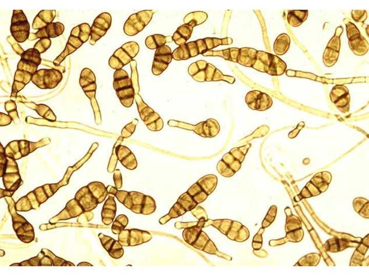 <p>Observation of hyaline or dematiacious hyphae is an early clue in the identification of common, airborne fungi. Which of the following genera contains species found as dematiacious contaminants?</p><p>Alternaria</p><p>Penicillium</p><p>Paecilomyces</p><p>Fusarium</p><p>Scopulariopsis</p>