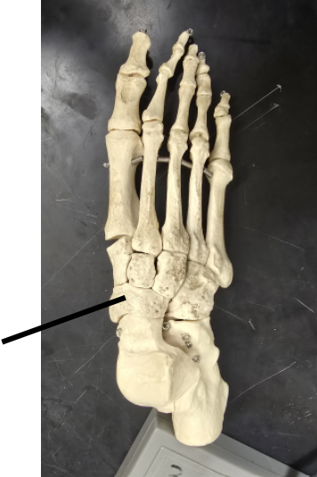 <p>Name Tarsal Bone</p>