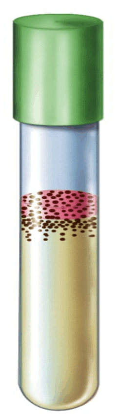 <p>Bacteria that are _______ _______ require oxygen to grow. So they will only grow at the top of the broth.</p>