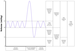 <p>inspiratory reserve volume</p>