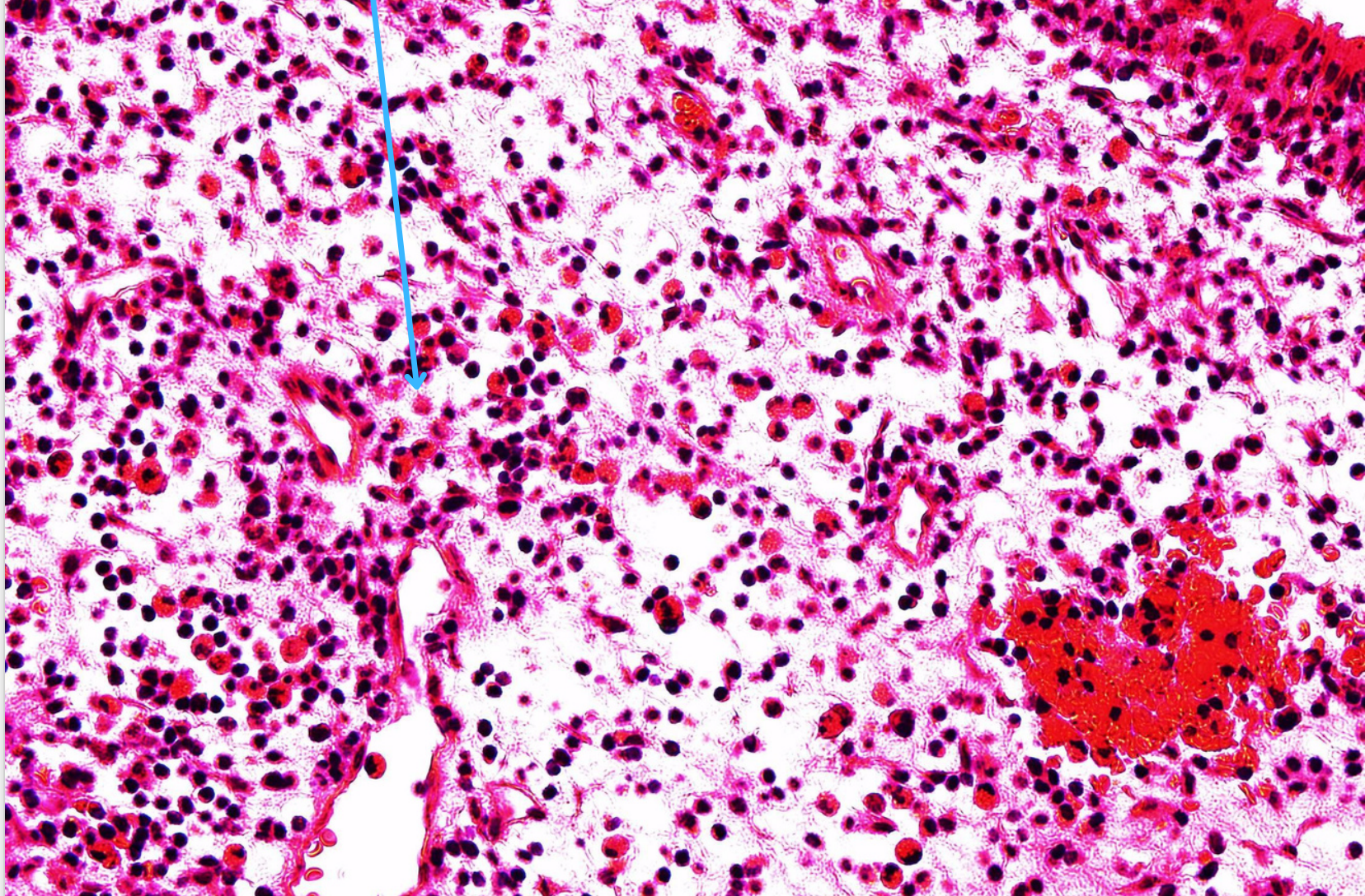 <p>Tiêu bản gì ?</p>